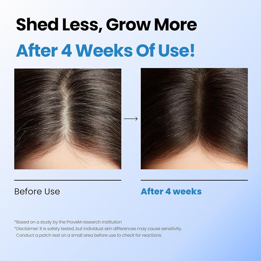 Scalpy Hair Growth Serum – سيروم سكالبى لنمو الشعر