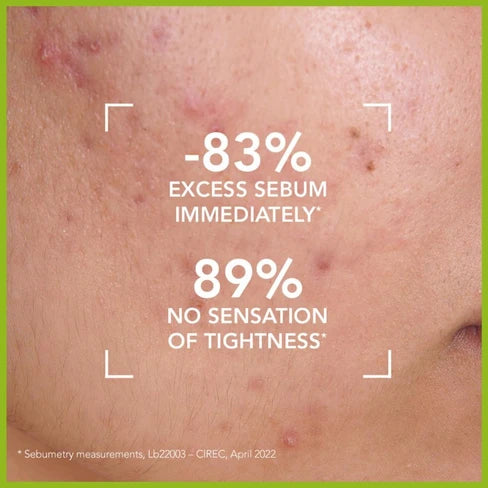 Sebium Purifying Gel – جل سيبيوم المنظف للبشرة الدهنية