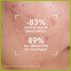 Sebium Purifying Gel – جل سيبيوم المنظف للبشرة الدهنية